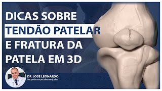 Dicas sobre tendão patelar tendão do quadríceps e fratura da patela em 3D  Dr José Leonardo [upl. by Dnalyag]