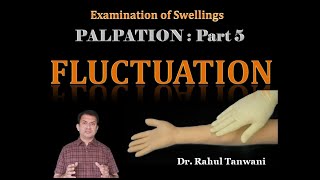 Palpation of Swellings  Part 5  Fluctuation [upl. by Haet]