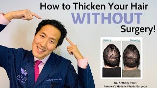 How to Treat Your Thinning Hair Holistically and Thicken it Without Surgery  Dr Anthony Youn [upl. by Acsisnarf]