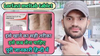 Lorfast meltab tablet use dose benefits and side effects full review in hindi loratadine [upl. by Raynor]