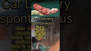 Amazing CAR BIRTH BABY 😘 Fetal Ejection Reflex ♥️💓💗 car delivery baby ♥️ shorts funny ♥️💗💓😘❤️‍🩹 [upl. by Atikir353]