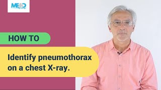 How to identify pneumothorax on a chest Xray [upl. by Collin]