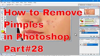 Learn Photoshop 28 How to remove pimples Photoshop in Telugu [upl. by Innad328]