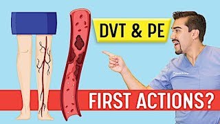 DVT Animation Deep Vein Thrombosis and Pulmonary Embolism PE Memory Tricks for Exams NCLEX [upl. by Schreck]