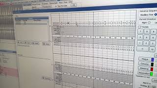 Charting Probing in a Returning Patient in Open Dental [upl. by Ahtera125]