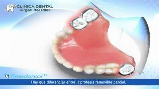 ¿Qué es una prótesis dental removible por Clínica Dental Virgen del Pilar [upl. by Ahsenar]