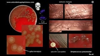 Streptococcus pneumoniae identifaction [upl. by Aieken]