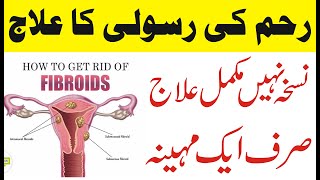 How To Treat Fibroids  Reham Mein Rasoli Ka Ilaj UrduHindi  Fibroids in UterusFibroids Ultrasound [upl. by Nosrej]