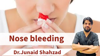 Nose Bleeding Dr Junaid Shahzad  JSK CLINICS [upl. by Bernadina]