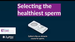 Sperm Selection Technology at Beacon CARE Fertility ZyMot [upl. by Yla262]