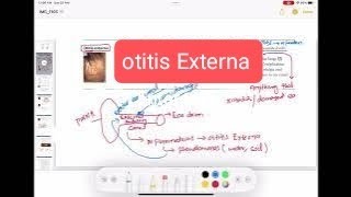 otitis externa amp Malignant otitis externa otorhinolaryngology 2  First Aid USMLE Step 1 [upl. by Desdemona491]