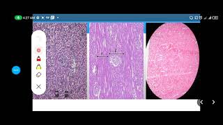 Histology Slides Series Episode 13  Histology of the Urinary System [upl. by Anikes201]