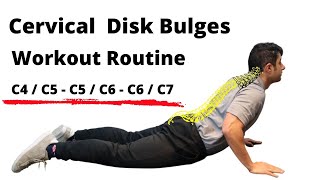 Workout routine for Cervical Disc Bulges  Beginner Level [upl. by Yardna123]