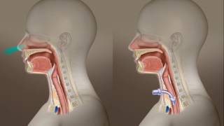 Tracheotomy Care What Is A Tracheotomy [upl. by Aneel]