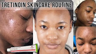 HOW TO GET RID OF ACNE amp ACNE SCARS  TRETINOIN SKINCARE ROUTINE ♡ OfficialTashika [upl. by Araiet397]