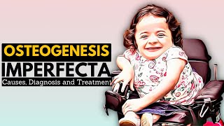 OSTEOGENESIS IMPERFECTA OI Causes Signs and Symptoms Diagnosis and Treatment [upl. by Taffy]