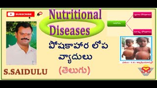 Nutritional deficiency diseases  Marasmus and Kwashiorkor  Types of nutrients  Macro nutrients [upl. by Jean232]