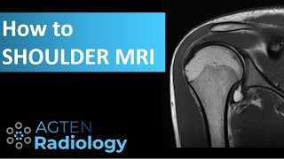 How to Assess Shoulder MRI [upl. by Cirde]