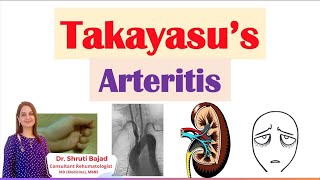 Takayasu Arteritis  Dr Shruti Bajad skincare arthritis autoimmunecare skin arthritispain [upl. by Drawe237]