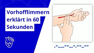 Was ist eigentlich Vorhofflimmern In einer Minute erklärt [upl. by Nelle]