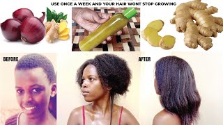 How I Use Onion and Ginger for Unstopable Hair Growth  4C Hair  Natural Hair [upl. by Graniah255]