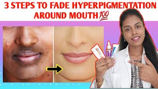 How to treat the Darkness around Mouth in tamil Causes and treatment of Pigmentation TAMILMEDTALKS [upl. by Odnam]