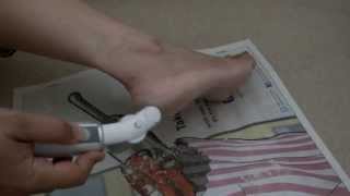 Dry cracked heel remedy  Emjoi Micro Pedi demo and review [upl. by Woermer]