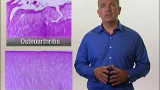 Arthritis in Dogs  Osteoarthritis [upl. by Randal]