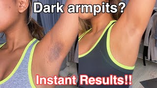 How To Get Rid Of Dark Armpits INSTANTLY 100 works [upl. by Yllatan]