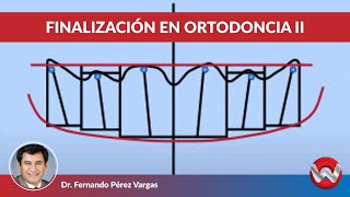 Finalizacion en ortodoncia II [upl. by Erlinna]