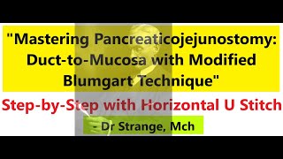 Pancreaticojejunostomy Theory amp Rationale YTT Karol Barreto DucttoMucosa Modified Blumgart [upl. by Corkhill199]