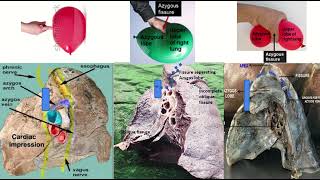 Azygos Vein amp Fissure on Radiology Xray CT amp MRI [upl. by Johst]