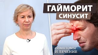 Как эффективно лечить гайморит синусит [upl. by Ahsinad]