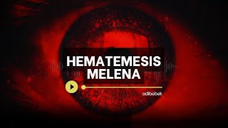 Hematemesis Melena [upl. by Sul]