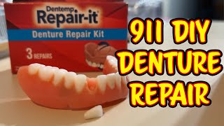 Emergency DIY Denture Repair [upl. by Dnarud]