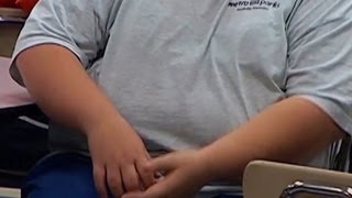 quotExtremequot obesity rising in kids [upl. by Branch93]