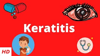 Keratitis Causes Signs and Symptoms Diagnosis and Treatment [upl. by Marzi498]