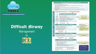 Difficult airway algorithm for ICU [upl. by Lagasse]