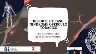 Reporte de caso Síndrome de Opérculo Torácico Venoso por Doble compresión [upl. by Burrell182]