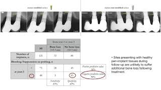 Surgical treatment of periimplantitis 3 year results from a randomized controlled clinical trial [upl. by Ennoryt379]