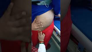 Female hip injection video new [upl. by Analeh]