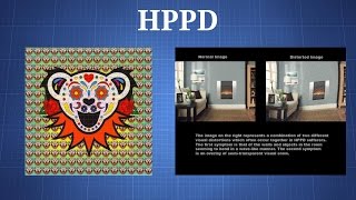 Hallucinogen Persisting Perception Disorder HPPD What You Need To Know [upl. by Tratner]