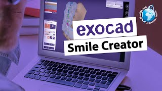 Exocad Smile Creator Enables an Evolved Digital Experience [upl. by Inalel]