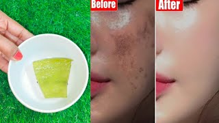 Aloe vera gel for glowing skin for dry skin  How to use aloe vera gel on face  Aloe vera gel [upl. by Nahraf]