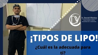 Tipos de liposucción ¿Cuál es la mejor lipo para mí  Abdominoplastia y Mini Dermo [upl. by Kaufmann]