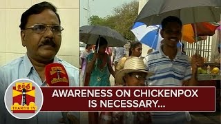 Awareness on Chickenpox is Necessary  Doctors  Thanthi TV [upl. by Rebbecca734]