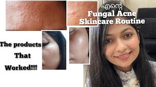 How I cleared My Fungal Acne  Skincare Routine for Fungal acne Products for Fungal Acne [upl. by Mcdowell]