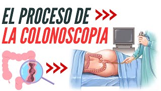 Todo lo que Debes Saber sobre la Colonoscopia y Salud del Colon [upl. by Hpesoj708]