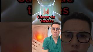 Síntomas de alerta de cáncer de tiroides  Dr William Guerrero medicina shorts [upl. by Alexandr]