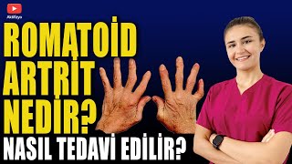 ROMATOİD ARTRİT NEDİR TEDAVİ NASIL YAPILIR [upl. by Hilaire]